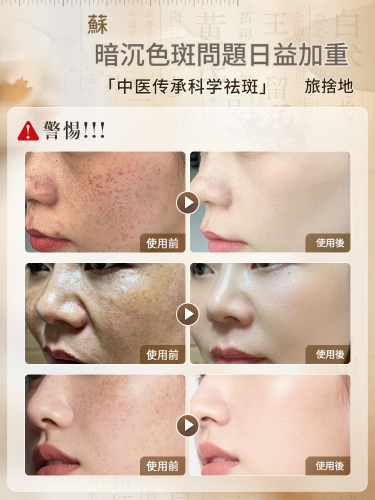 美白祛斑乳霜提亮去黃改善暗沉保濕補水淡祛色斑黃褐斑雀斑菸鹼醯胺