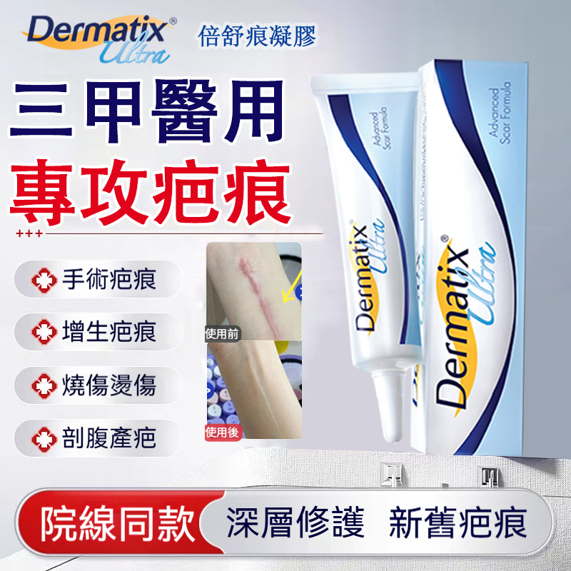 倍舒痕Dermatix祛疤膏手術增生疤痕修復醫用矽酮凝膠剖腹產 手術疤 增生疤 燙傷疤