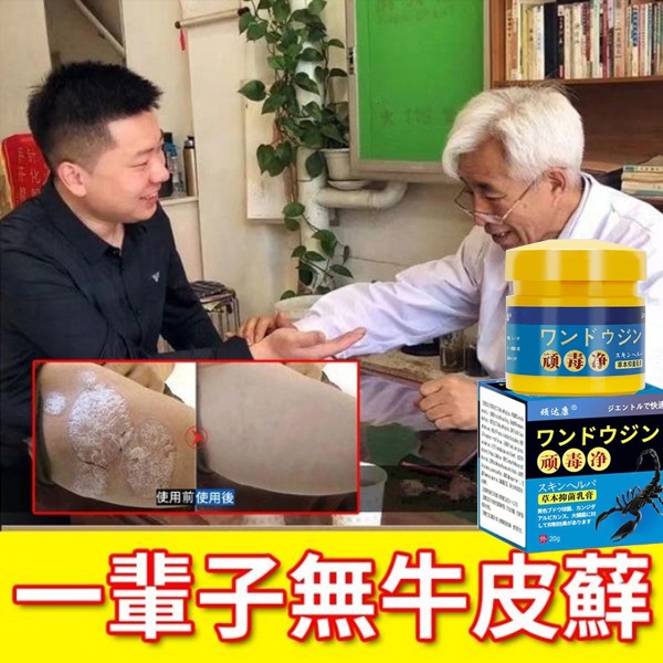 【日本醫學院韓教授推薦頑毒凈草本抑菌軟膏】 先止癢 後殺菌 好後200%不再犯，中藥調製，0%添加，治牛皮廯、銀屑病、手足廯等，皮膚真菌疾病！
