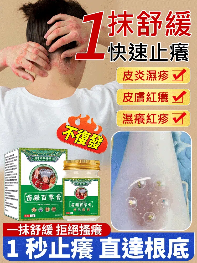 李時珍苗疆百草膏斷癢奇草真菌王癬皮膏雲南本草止癢膏