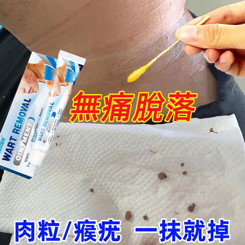 【專注皮膚問題！祛痣、袪老人斑、祛疣、祛肉刺、祛死皮、還你嬰兒粉嫩肌膚！一次祛除永不復發！】克疣膏