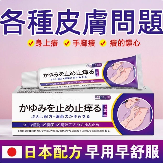 【日本止癢王】特效止癢皮膚發紅全身乾癢止癢膏植物草本抑菌乳膏